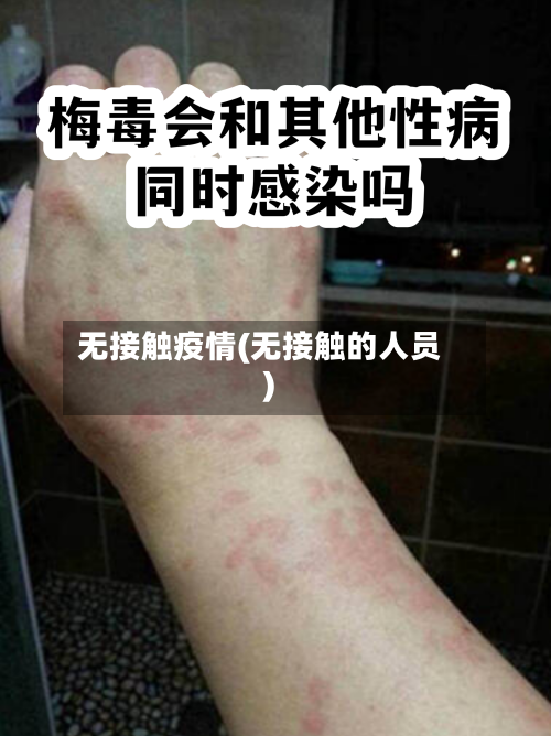无接触疫情(无接触的人员)